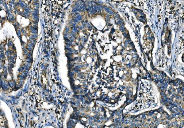 Anti-CX3CR1 Antibody Boster Bio