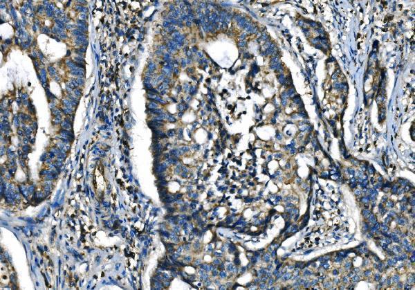 Anti-CX3CR1 Antibody Boster Bio