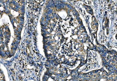Anti-CX3CR1 Antibody Boster Bio