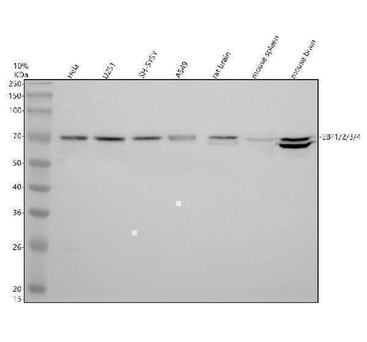 Anti-ARHI/DIRAS3 Antibody Picoband® Boster Bio