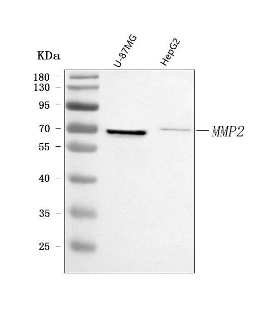 Anti-MMP2 Antibody Picoband® Boster Bio
