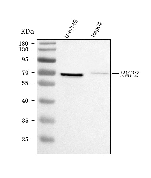 Anti-MMP2 Antibody Picoband® Boster Bio
