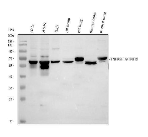 Anti-TNFRSF1A Antibody Picoband® Boster Bio