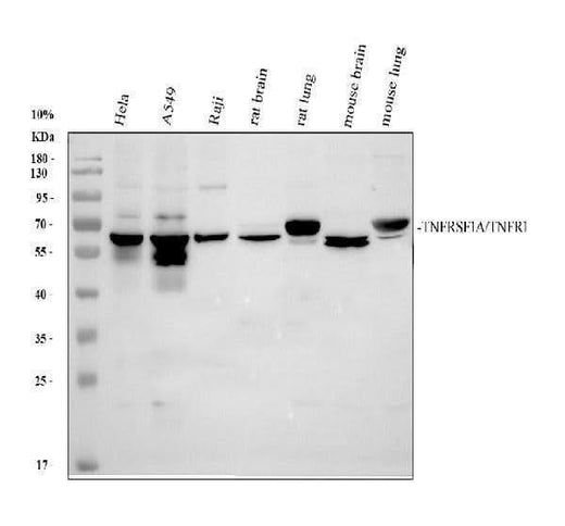 Anti-TNFRSF1A Antibody Picoband® Boster Bio