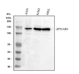 Anti-IFNAR1 Antibody Picoband® Boster Bio