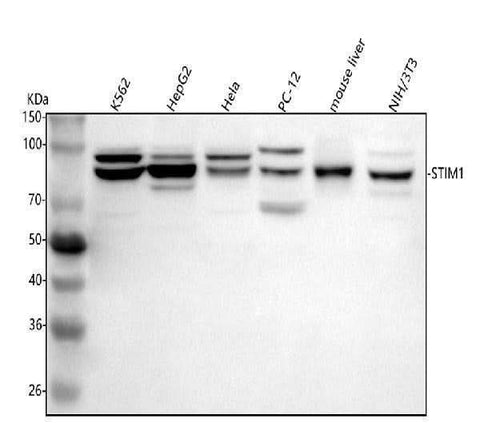 Anti-STIM1 Antibody Picoband® Boster Bio