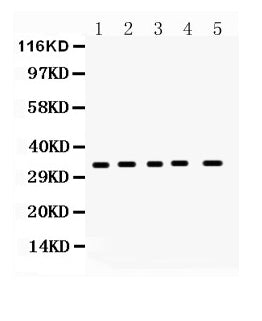 Anti-Superoxide Dismutase 4/CCS Antibody Picoband® Boster Bio