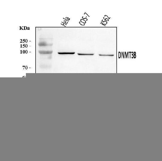 Anti-DNMT3B Antibody Picoband® Boster Bio