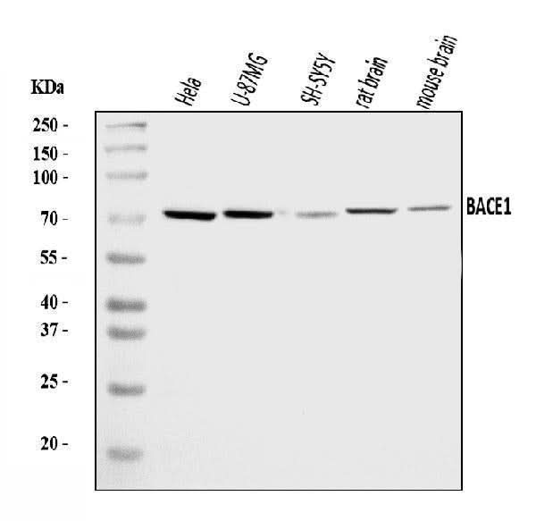Anti-BACE1 Antibody Picoband® Boster Bio