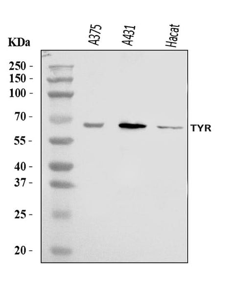 Anti-Tyrosinase/TYR Antibody Picoband® Boster Bio