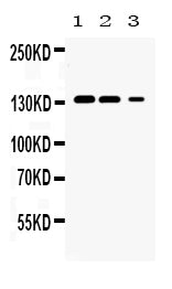 Anti-JAK1 Antibody Picoband® Boster Bio