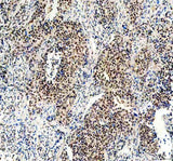 Anti-Menin/MEN1 Picoband® Antibody Boster Bio