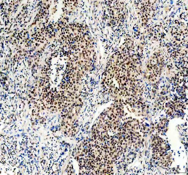 Anti-Menin/MEN1 Picoband® Antibody Boster Bio