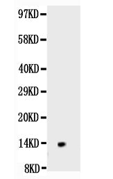 Anti-NGF/NGF Beta Antibody Picoband® Boster Bio