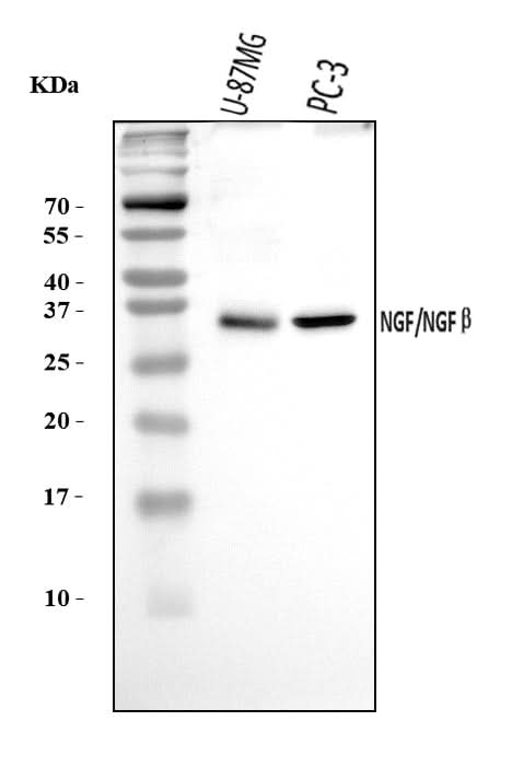 Anti-NGF Antibody Picoband® Boster Bio