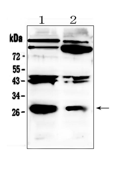 Anti-PDGF beta/PDGFB Antibody Picoband® Boster Bio