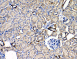 Anti-Leptin Receptor/LEPR Antibody Boster Bio