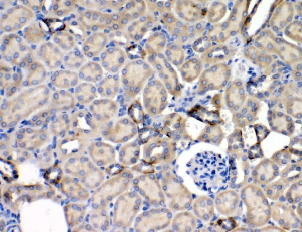 Anti-Leptin Receptor/LEPR Antibody Boster Bio
