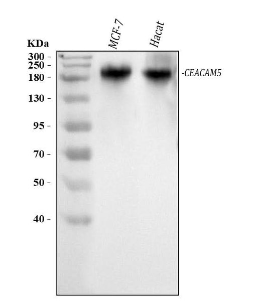 Anti-CEA/CEACAM5 Antibody Picoband® Boster Bio