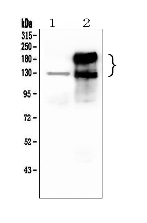 Anti-CEACAM5 Antibody Picoband® Boster Bio