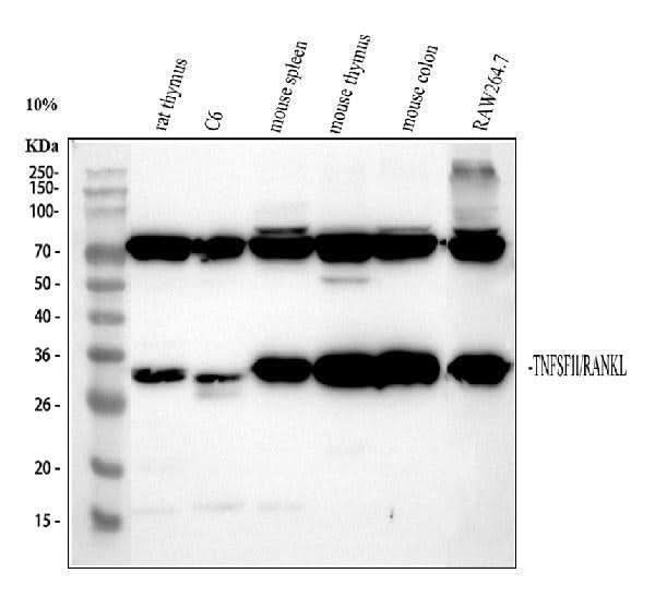 Anti-TNFSF11 Antibody Picoband® Boster Bio