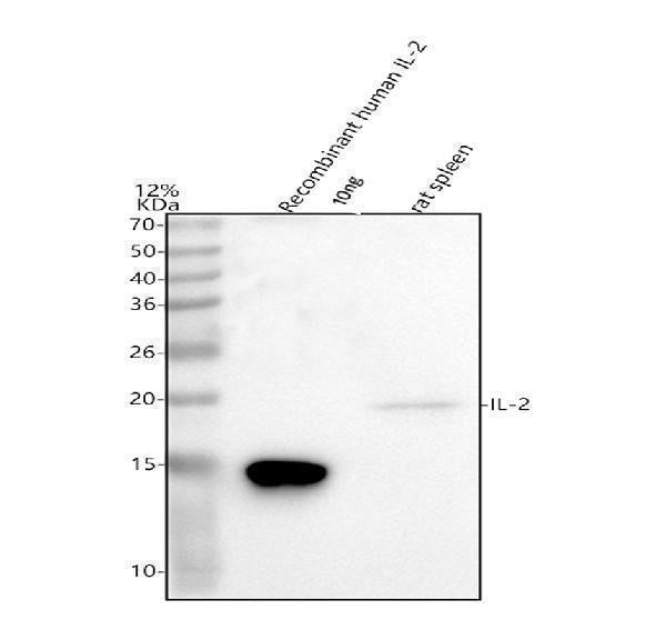 Anti-IL2 Antibody Picoband® Boster Bio