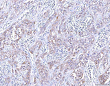 Anti-CCR7 Antibody Boster Bio