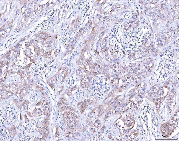 Anti-CCR7 Antibody Boster Bio