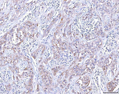 Anti-CCR7 Antibody Boster Bio