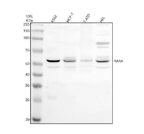 Anti-RARA Antibody Picoband® Boster Bio