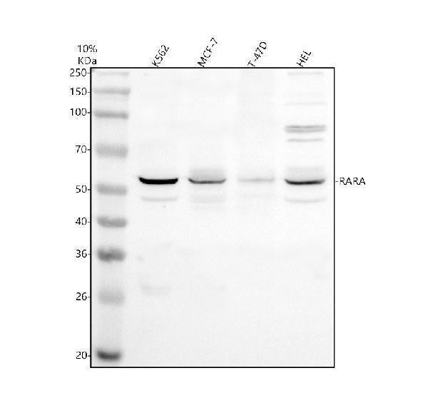 Anti-RARA Antibody Picoband® Boster Bio