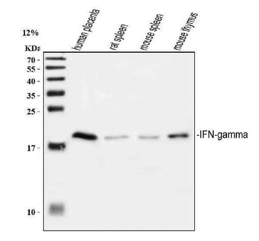 Anti-Interferon gamma/IFNG Antibody Picoband® Boster Bio