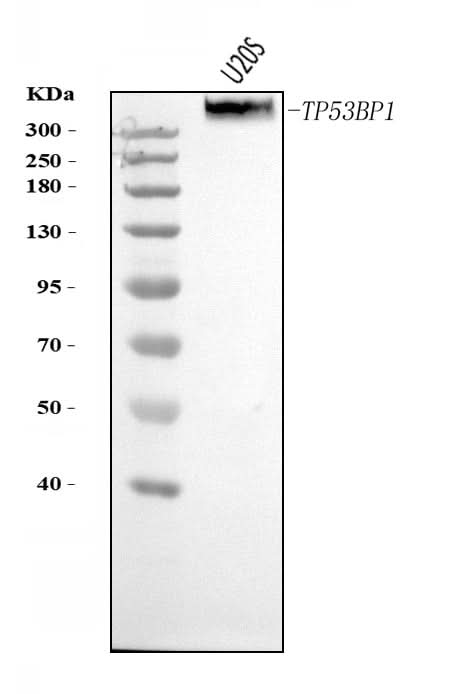 Anti-53BP1/TP53BP1 Antibody Picoband® Boster Bio
