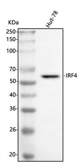 Anti-MUM1/IRF4 Antibody Picoband® Boster Bio