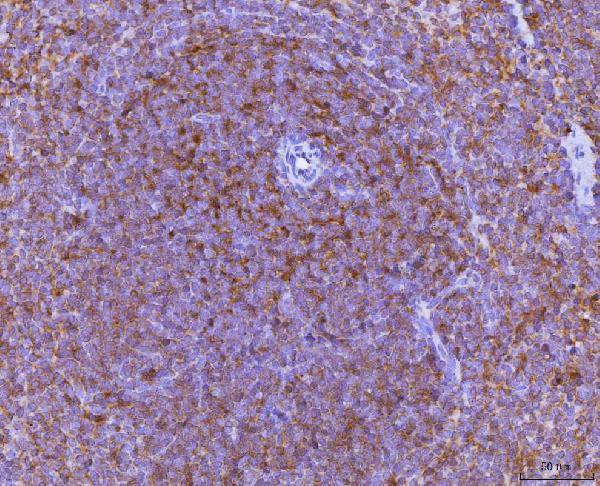 Anti-Ccl3 Antibody Boster Bio