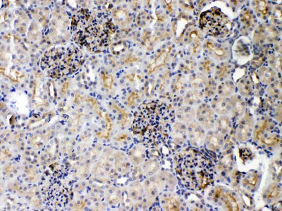 Anti-DR5/TNFRSF10B Antibody Picoband® Boster Bio