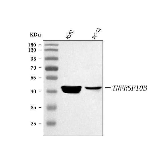 Anti-DR5/TNFRSF10B Antibody Picoband® Boster Bio