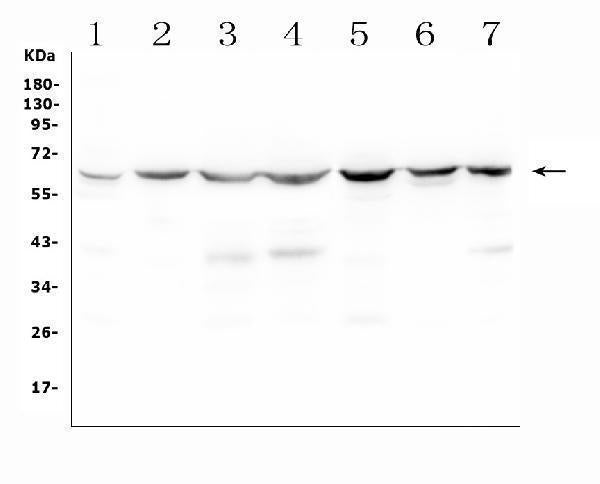 Anti-C9ORF72 Antibody Picoband® Boster Bio