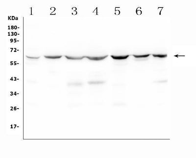 Anti-C9ORF72 Antibody Picoband® Boster Bio