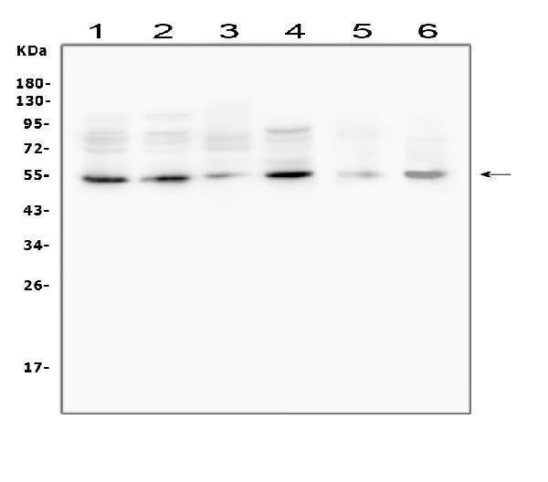 Anti-MMP13 Antibody Picoband® Boster Bio