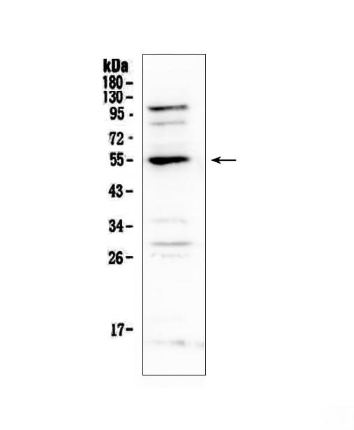Anti-EPO Receptor/EPOR Antibody Picoband® Boster Bio