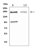 Anti-Niemann Pick C1/NPC1 Antibody Picoband® Boster Bio
