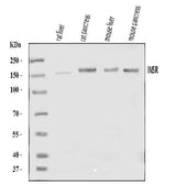 Anti-Insulin Receptor/INSR Antibody Picoband® Boster Bio