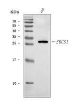 Anti-SOCS1 Antibody Picoband® Boster Bio