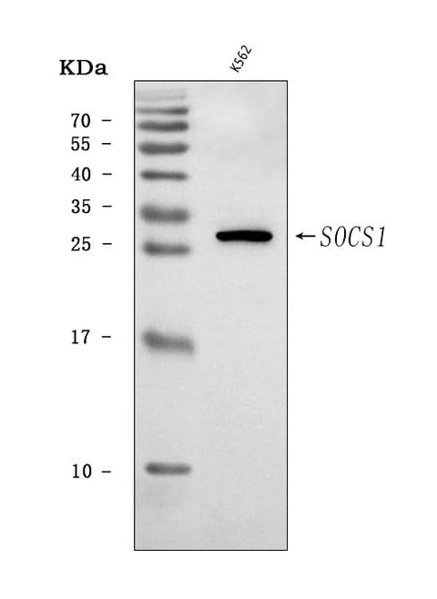 Anti-SOCS1 Antibody Picoband® Boster Bio