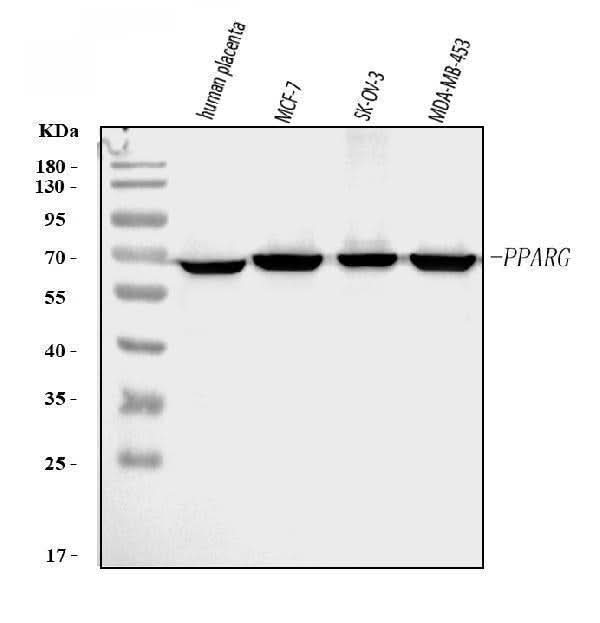 Anti-PPAR gamma/PPARG Antibody Picoband® Boster Bio