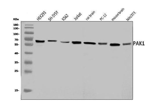 Anti-PAK1 Antibody Picoband® Boster Bio
