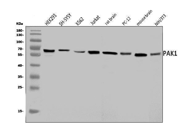 Anti-PAK1 Antibody Picoband® Boster Bio
