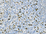 Anti-CXCR2 Antibody Boster Bio