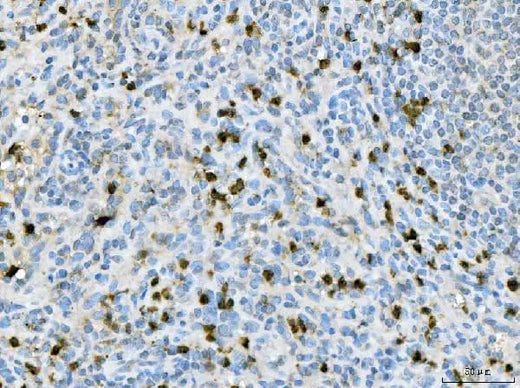 Anti-CXCR2 Antibody Boster Bio